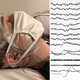 Electrical signals from a sleeping person’s brain are shown on the monitor.